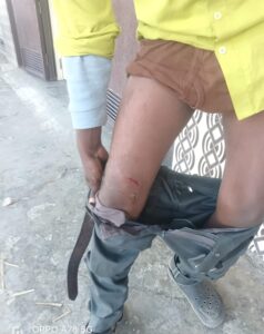 पालतू पिटबुल के हमले से युवक घायल, बना दहशत का माहौल, पीड़ित ने थाने थाने में दी तहरीर