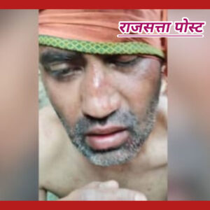 यूपी में 24 घंटे में तीन हत्याएं करने वाला साइको किलर एनकाउंटर में ढेर, ट्रेन और अस्पताल बना था निशाना