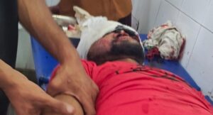 पिकअप-बाइक की आमने-सामने की टक्कर, उपचार के दौरान युवक की मौत