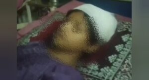 मासूम बच्ची के सिर पर डंडे से वार, पिता से मारपीट, तीन के खिलाफ मुकदमा